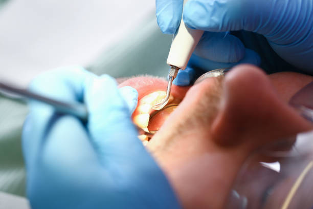 Best Emergency TMJ Treatment in Wilkshire Hills, OH